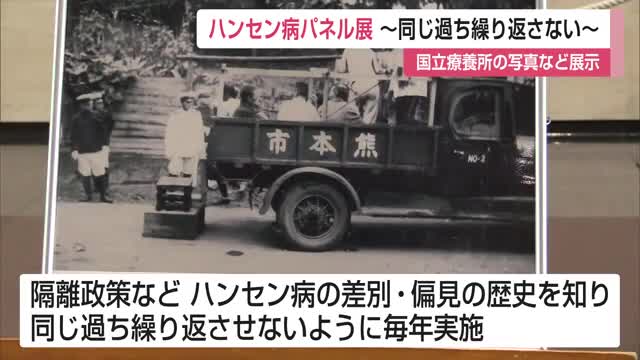 「同じ過ちを繰り返さない…差別や偏見のない社会を」国立療養所などハンセン病の歴史を展示【佐賀県】