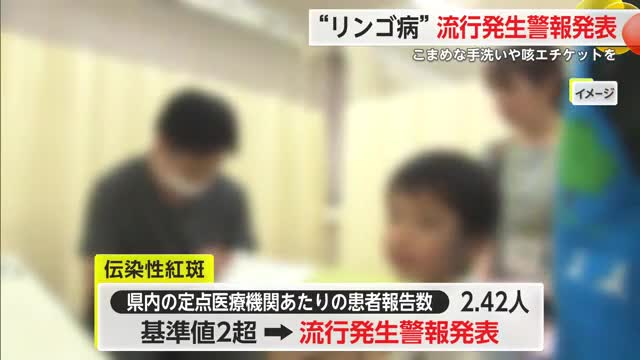 「リンゴ病」流行発生警報発表 こまめな手洗いや咳エチケットを【佐賀県】