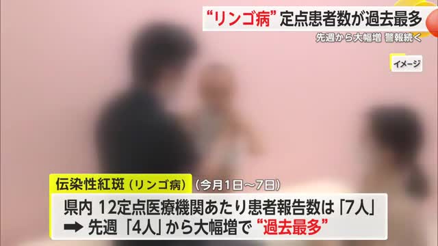 “リンゴ病”定点患者数過去最多 先週から大幅増で警報継続中【佐賀県】