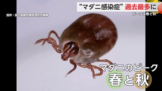 “マダニ感染症”過去最多更新 ピークは春と秋 自分で取り除かずすぐ医療機関受診を【佐賀県】