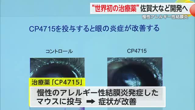 世界初“分子治療薬”開発へ 慢性のアレルギー性結膜炎の原因解明に取り組む【佐賀県】